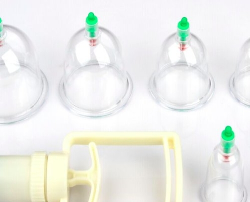 Learning Hijama (Cupping)